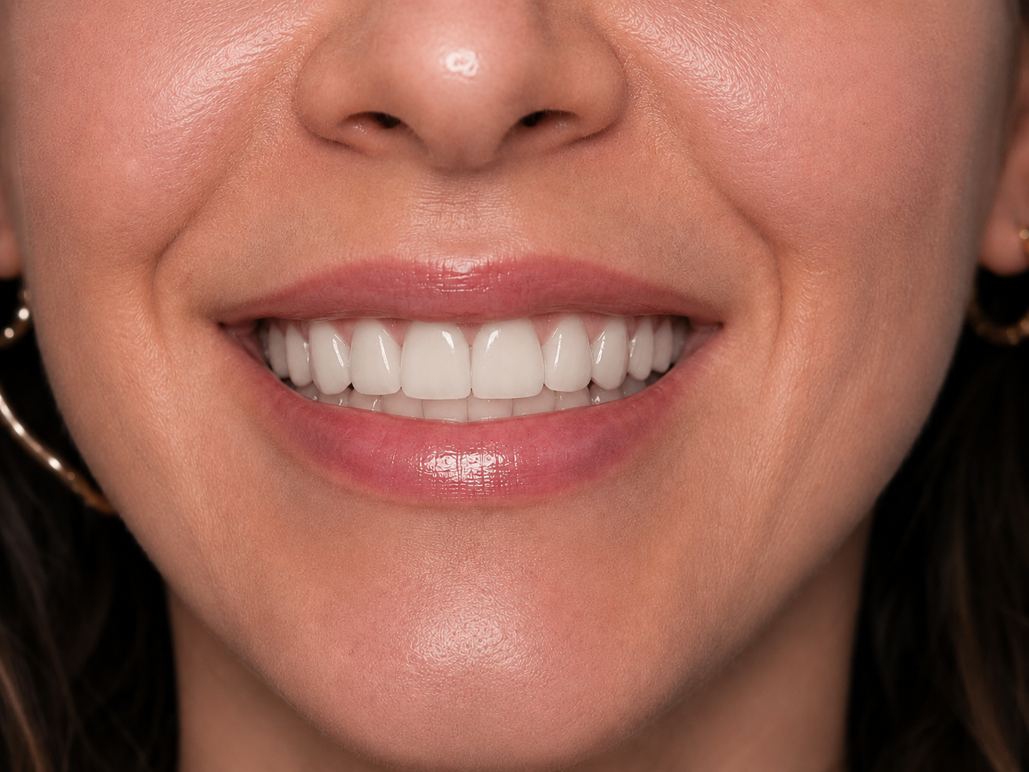 Before dental implant — missing tooth